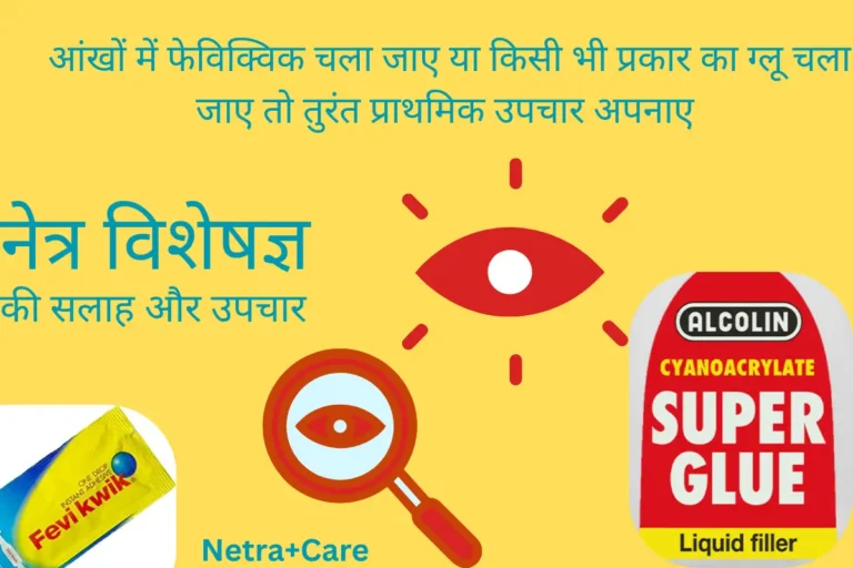 “आंख में फेविक्विक चला जाए तो क्या करें? प्राथमिक उपचार विशेषज्ञ की सलाह
