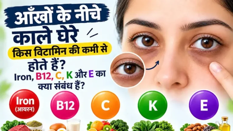 आंखों के नीचे काले घेरे किस विटामिन की कमी से होते हैं – Iron, B12, C, K और E क्या संबंध है?