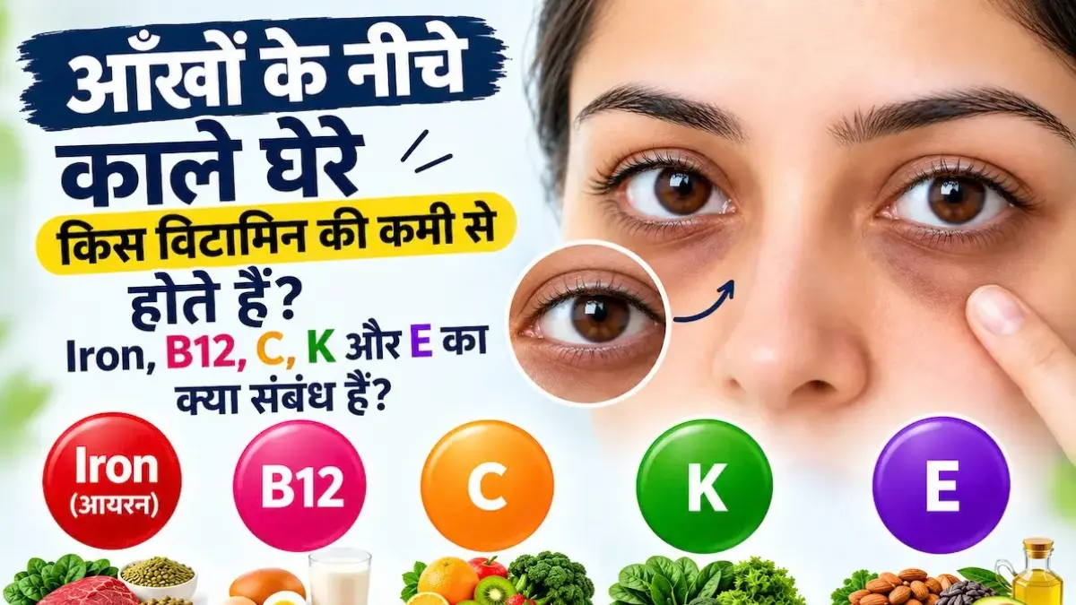 आंखों के नीचे काले घेरे किस विटामिन की कमी से होते हैं – Iron, B12, C, K और E क्या संबंध है?